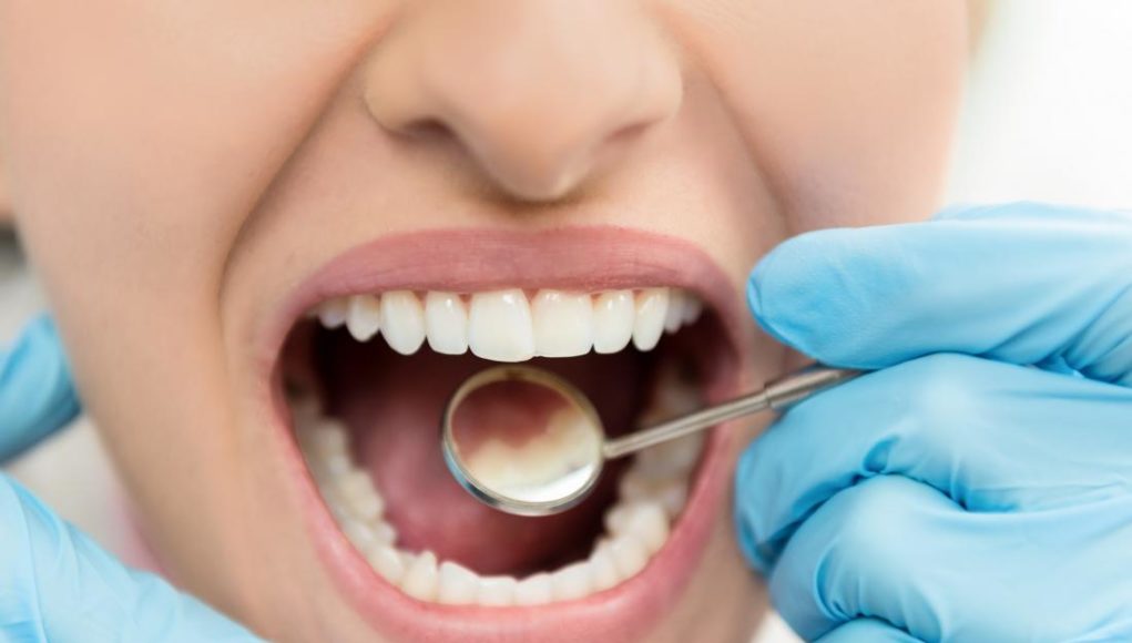 5 Ways To Prevent Dental Cavities Weird Worm